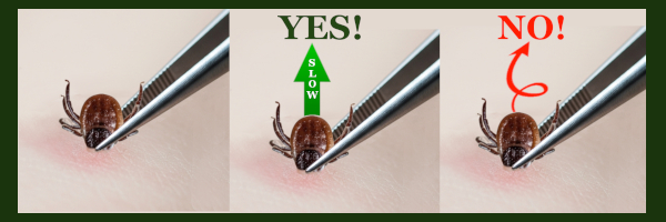 TickRemoval1 - MOMAROMAs: Your Guide to Aromatherapy, DIY Essential Oils, and Natural Wellness How to remove a tick safely during a tick bite